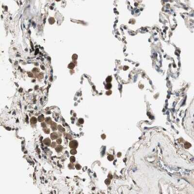 Immunohistochemistry-Paraffin: TMPRSS4 Antibody [NBP1-82608] - Staining of human Lung shows moderate membranous and cytoplasmic positivity in pneumocytes.