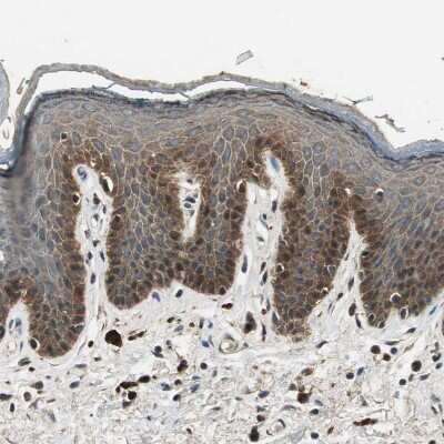 Immunohistochemistry-Paraffin: TMPRSS4 Antibody [NBP1-82608] - Staining of human Skin shows moderate membranous and cytoplasmic positivity in squamous epithelial cells.
