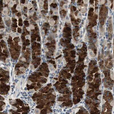 Immunohistochemistry-Paraffin: TMPRSS4 Antibody [NBP1-82608] - Staining of human Stomach shows strong membranous and cytoplasmic positivity in glandular cells.