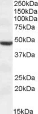 Western Blot TMPRSS4 Antibody