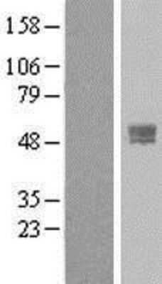 Western Blot TMPRSS4 Overexpression Lysate