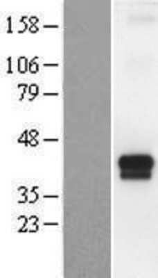 Western Blot: TMPRSS4 Overexpression Lysate [NBP2-10066] - (Adult Normal) [NBP2-10066] Left-Empty vector transfected control cell lysate (HEK293 cell lysate); Right -Over-expression Lysate for TMPRSS4. The observed molecular weight is approximately 40 kDa.