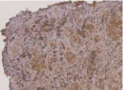 Immunohistochemistry: TMSB15B Antibody [NBP2-38054] - Thymosin beta expression on prostate tissue. This image was submitted via customer Review.