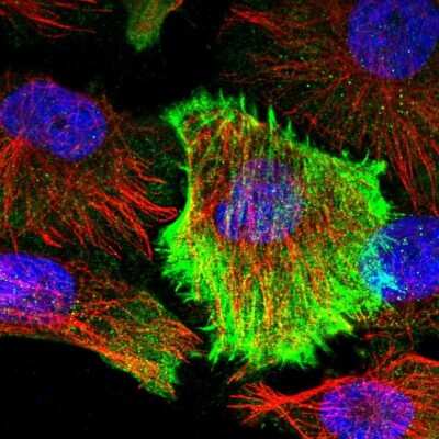 Immunocytochemistry/ Immunofluorescence TMTC2 Antibody