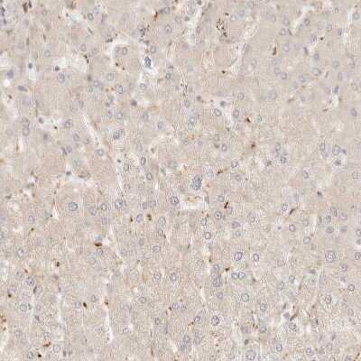 Immunohistochemistry-Paraffin: TMTC2 Antibody [NBP1-85027] - Staining of human liver shows weak cytoplasmic positivity in hepatocytes.