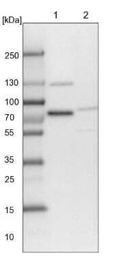 Western Blot: TMTC2 Antibody [NBP1-85027] - Lane 1: NIH-3T3 cell lysate (Mouse embryonic fibroblast cells)Lane 2: NBT-II cell lysate (Rat Wistar bladder tumour cells)
