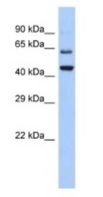 Western Blot: TMTC2 Antibody [NBP3-09267] - Western blot analysis of TMTC2 in Hela Whole cell lysates. Antibody dilution at 1.0ug/ml