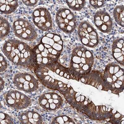 Immunohistochemistry-Paraffin: TMTC3 Antibody [NBP1-93728] - Staining of human colon shows strong cytoplasmic and membranous positivity in glandular cells.