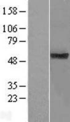 Western Blot: TMUB1 Overexpression Lysate (Adult Normal) [NBP2-06128] Left-Empty vector transfected control cell lysate (HEK293 cell lysate); Right -Over-expression Lysate for TMUB1.