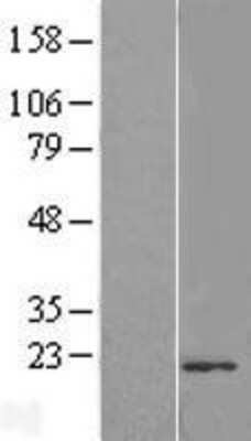 Western Blot: TMUB2 Overexpression Lysate (Adult Normal) [NBP2-09915] Left-Empty vector transfected control cell lysate (HEK293 cell lysate); Right -Over-expression Lysate for TMUB2.