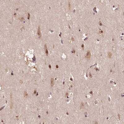 Immunohistochemistry-Paraffin: TMX2 Antibody [NBP2-49405] - Staining of human Cerebral cortex shows moderate granular cytoplasmic positivity in neuronal cells.