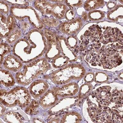Immunohistochemistry-Paraffin: TMX2 Antibody [NBP2-49405] - Staining of human Kidney shows strong granular cytoplasmic positivity in cells in tubules and glomeruli.