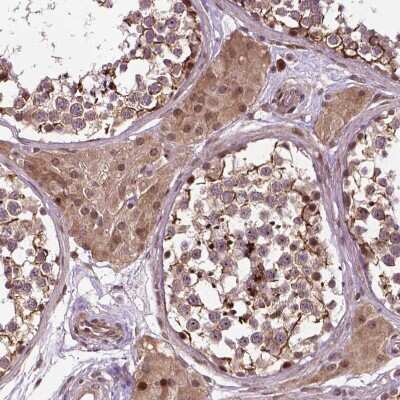 Immunohistochemistry-Paraffin: TMX2 Antibody [NBP2-49405] - Staining of human Testis shows moderate granular cytoplasmic positivity in Leydig cells and cells in seminiferous ducts.