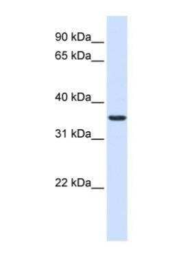Western Blot: TMX2 Antibody [NBP1-69586] - This Anti-TXNDC14 antibody was used in Western Blot of Fetal Liver tissue lysate at a concentration of 1ug/ml.