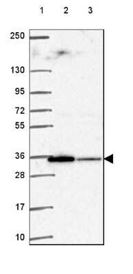 Western Blot: TMX2 Antibody [NBP2-49405] - Lane 1: Marker [kDa] 250, 130, 95, 72, 55, 36, 28, 17, 10Lane 2: Human cell line RT-4Lane 3: Human cell line U-251 MG
