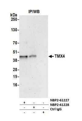 Immunoprecipitation: TMX4 Antibody [NBP2-61227] - Samples: Whole cell lysate (1.0 mg per IP reaction; 20% of IP loaded) from HeLa cells prepared using NETN lysis buffer. Antibodies: Affinity purified rabbit anti-TMX4 antibody NBP2-61227 used for IP at 8 ul per reaction. TMX4 was also immunoprecipitated by rabbit anti-TMX4 antibody NBP2-61228. For blotting immunoprecipitated TMX4, NBP2-61227 was used at 1:1000. Detection: Chemiluminescence with an exposure time of 30 seconds.
