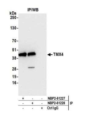 Immunoprecipitation: TMX4 Antibody [NBP2-61228] - Detection of human TMX4 by western blot of immunoprecipitates. Samples: Whole cell lysate (1.0 mg per IP reaction; 20% of IP loaded) from HeLa cells prepared using NETN lysis buffer. Antibodies: Affinity purified rabbit anti-TMX4 antibody NBP2-61228 used for IP at 20 ul per reaction. TMX4 was also immunoprecipitated by rabbit anti-TMX4 antibody NBP2-61227. For blotting immunoprecipitated TMX4, NBP2-61228 was used at 1:250. Detection: Chemiluminescence with an exposure time of 10 seconds.