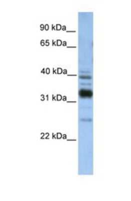 Western Blot: TMX4 Antibody [NBP1-69606] - This Anti-TXNDC13 antibody was used in Western Blot of Fetal Liver tissue lysate at a concentration of 1ug/ml.