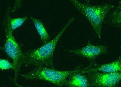 Immunocytochemistry/Immunofluorescence: TNF RI/TNFRSF1A Antibody (001) [NBP2-89687] - Staining of Human TNFRI in Hela cells. Cells were fixed with 4% PFA, permeabilzed with 0.3% Triton X-100 in PBS, blocked with 10% serum, and incubated with rabbit anti-Human TNFRI monoclonal antibody (1:60) at 4c overnight. Then cells were stained with the Alexa Fluor(R) 488-conjugated Goat Anti-rabbit IgG secondary antibody (green) and counterstained with DAPI (blue). Positive staining was localized to cytoplasm.