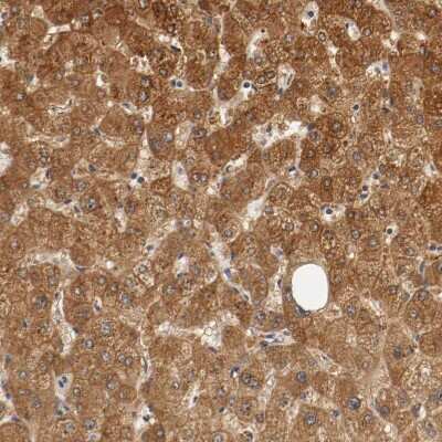 Immunohistochemistry-Paraffin: TNF RII/TNFRSF1B Antibody [NBP1-88139] - Staining of human liver shows moderate membranous positivity in hepatocytes.