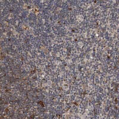 Immunohistochemistry-Paraffin: TNF RII/TNFRSF1B Antibody [NBP1-88139] - Staining of human lymph node shows moderate membranous positivity in non-germinal center cells.