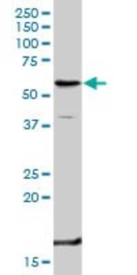 Western Blot: TNF RII/TNFRSF1B Antibody [H00007133-D01P] - Analysis of TNFRSF1B expression in mouse testis.