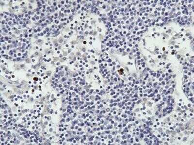 Immunohistochemistry: TNF-alpha Antibody (52B83) - BSA Free [NBP2-48484] - TNF alpha in sheep tonsil FFPE. Image from verified customer review.