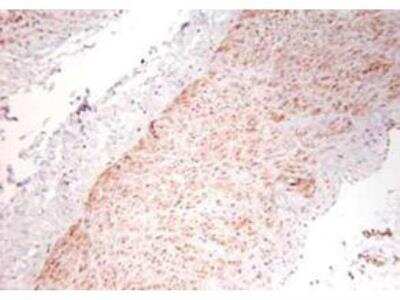 Immunohistochemistry: TNF-alpha Antibody [NBP2-44062] - Staining of formalin/PFA-fixed paraffin-embedded sections of human artery tissue sections. Sections were fixed in formaldehyde and subjected to heat mediated antigen retrieval in citrate buffer (pH 6.0). Slides were blocked for ten minutes with 1.5% serum. Primary antibody was diluted 1:100 and incubated with samples for 24 hours at 4C. HRP-conjugated goat anti-rabbit antibody was used as the secondary antibody.