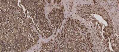 Immunohistochemistry: TNF-alpha Antibody [NBP2-44062] - Human prostate tissue was stained using TNFa antibody. This image was submitted via customer Review.