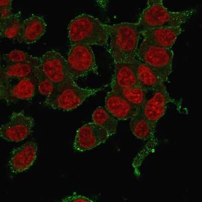 Immunocytochemistry/Immunofluorescence: TNF-alpha Antibody (P/T2) [NBP2-34302] - Immunofluorescence staining of HePG2 cells using TNF-alphaMouse Monoclonal Antibody (P/T2) followed by goat anti-mouse IgG-CF488. Counterstained with RedDot.