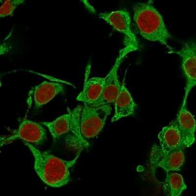 Immunocytochemistry/Immunofluorescence: TNF-alpha Antibody (TNFA/1172) [NBP2-45331] - Immunofluorescence Analysis of PFA-fixed HePG2 cells labeling TNF-alpha with TNF-alpha Antibody (TNFA/1172) followed by Goat anti-Mouse IgG-CF488 (Green). The nuclear counterstain is Red Dot.