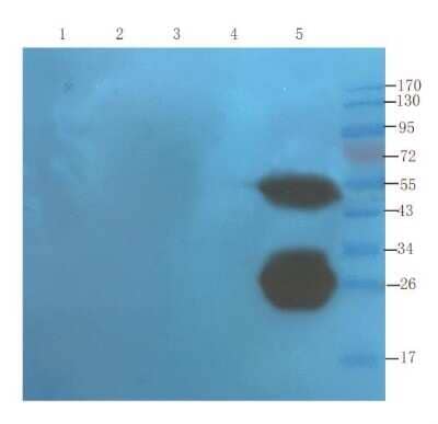 Western Blot: TNF-alpha Antibody (cA2 (Infliximab)) - Chimeric [NBP2-75898] - Mouse liver (lane 1), mouse spinal cord (lane 2), mouse testis (lane 3), mouse colon (lane 4) and human thyroid tumour (lane 5) samples were resolved on a 10% SDS PAGE gel and blots probed with NBP2-75898 at 1.5 ug/ml before being detected by a secondary antibody. The expected band size (269 kDa) is seen in the human-derived samples, as well as a band corresponding to dimers.