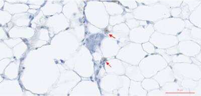 Immunohistochemistry: TNF alpha Variant Antibody (Z74P2C5*A12) [NBP2-61611] - Immunohistochemistry image showing positive staining of TNF alpha Variant Antibody (Z74P2C5*A12) in adipose tissue vaccinated rainbow trout. IHC was performed on formalin-fixed, paraffin-embedded tissue sections. Antigen retrieval step is required, which involves microwaving tissue for 20 minutes @ 800W in 10 mM citrate buffer (pH 6.0).