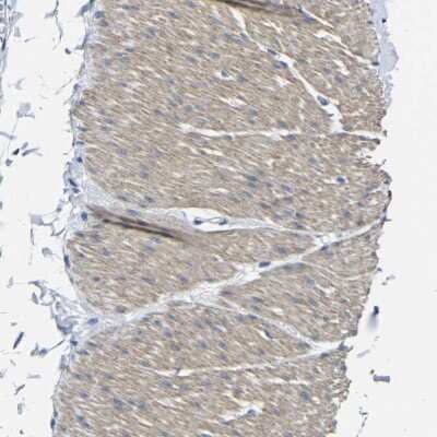 Immunohistochemistry-Paraffin: TNFAIP1 Antibody [NBP1-88930] - Staining of human smooth muscle shows moderate cytoplasmic positivity in smooth muscle cells.