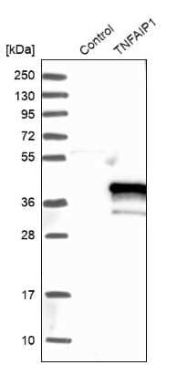 Western Blot: TNFAIP1 Antibody [NBP1-88931] - Analysis in control (vector only transfected HEK293T lysate) and TNFAIP1 over-expression lysate (Co-expressed with a C-terminal myc-DDK tag (3.1 kDa) in mammalian HEK293T cells).