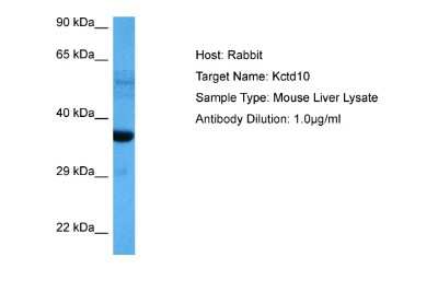 Western Blot: TNFAIP1 Antibody [NBP2-85959] - Host: Rabbit. Target Name: KCTD10. Sample Tissue: Mouse Liver lysates. Antibody Dilution: 1.0ug/ml