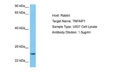 Western Blot: TNFAIP1 Antibody [NBP2-85962] - Host: Rabbit. Target Name: TNFAIP1. Sample Tissue: Human U937 Whole Cell lysates. Antibody Dilution: 1ug/ml