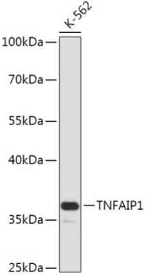 Western Blot: TNFAIP1 Antibody [NBP2-94181] - Analysis of extracts of K-562 cells, using TNFAIP1 at 1:1000 dilution.Secondary antibody: HRP Goat Anti-Rabbit IgG (H+L) at 1:10000 dilution.Lysates/proteins: 25ug per lane.Blocking buffer: 3% nonfat dry milk in TBST.Detection: ECL Basic Kit .Exposure tim