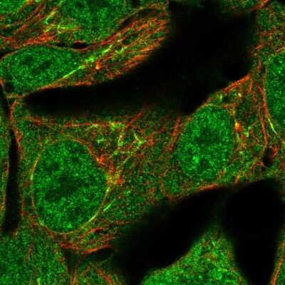 Immunocytochemistry/Immunofluorescence: TNFAIP2 Antibody [NBP2-55173] - Staining of human cell line RT4 shows localization to nucleoplasm, nuclear membrane, cytosol & the Golgi apparatus.