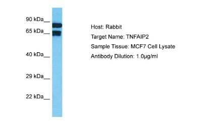 Western Blot: TNFAIP2 Antibody [NBP2-88445] - Host: Rabbit. Target Name: TNFAIP2. Sample Tissue: Human MCF7 Whole Cell. Antibody Dilution: 1ug/ml