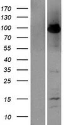 Western Blot A20/TNFAIP3 Overexpression Lysate