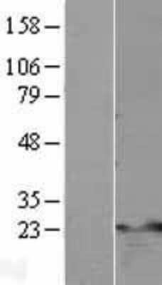 Western Blot: TNFAIP8 Overexpression Lysate (Adult Normal) [NBL1-17138] Left-Empty vector transfected control cell lysate (HEK293 cell lysate); Right -Over-expression Lysate for TNFAIP8.