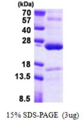SDS-Page: TNFAIP8 Protein [NBP2-22908]