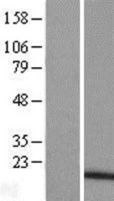 Western Blot: TNFAIP8L1 Overexpression Lysate (Adult Normal) [NBP2-05394] Left-Empty vector transfected control cell lysate (HEK293 cell lysate); Right -Over-expression Lysate for TNFAIP8L1.