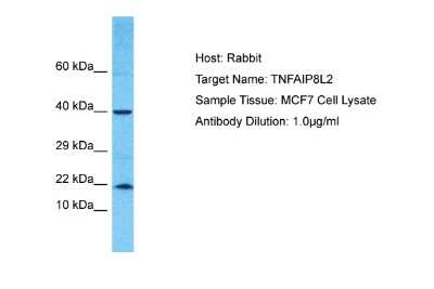 Western Blot: TNFAIP8L2 Antibody [NBP2-86869] - Host: Rabbit. Target Name: TNFAIP8L2. Sample Type: MCF7 Whole cell lysates. Antibody Dilution: 1.0ug/ml