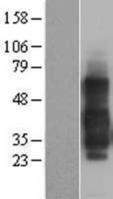 Western Blot: TNFRSF14 Overexpression Lysate (Adult Normal) [NBL1-17150] Left-Empty vector transfected control cell lysate (HEK293 cell lysate); Right -Over-expression Lysate for TNFRSF14.