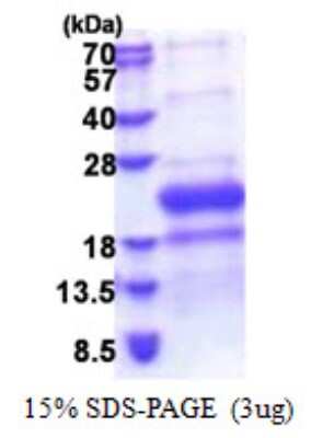 SDS-Page: TNFRSF14 Protein [NBP2-22904]