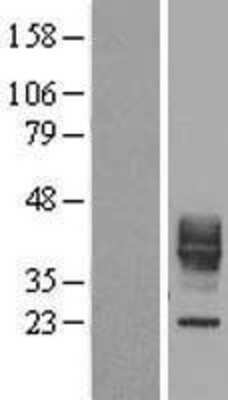 Western Blot CD30 Ligand/TNFSF8 Overexpression Lysate