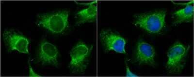 <b>Genetic Strategies Validation. </b>Immunocytochemistry/Immunofluorescence: TNIK Antibody [NBP3-13022] - TNIK antibody detects TNIK protein at cytoplasm by immunofluorescent analysis. Sample: HeLa cells were fixed in 4% paraformaldehyde at RT for 15 min. Green: TNIK protein stained by TNIK antibody (NBP3-13022) diluted at 1:500. Red: alpha Tubulin, a cytoskeleton marker, stained by alpha Tubulin antibody [B-5-1-2] diluted at 1:10000. Blue: Hoechst 33342 staining.