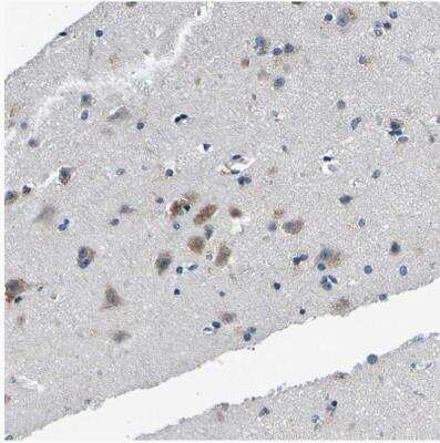 Immunohistochemistry-Paraffin TNIK Antibody